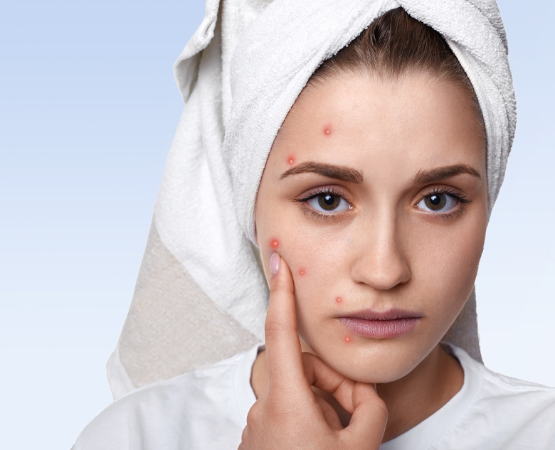 780×633-Pigmentation